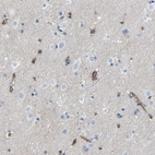 Immunohistochemical staining of human cerebral cortex shows strong cytoplasmic positivity in endothelial cells.