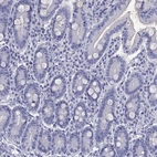 Immunohistochemical staining of human duodenum shows no positivity in glandular cells as expected.