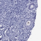 Immunohistochemical staining of human ovary shows moderate nuclear positivity in oocyte.