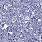 Immunohistochemical staining of human ovary shows moderate nuclear positivity in oocyte.