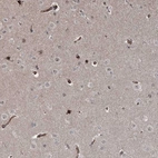Immunohistochemical staining of human cerebral cortex shows moderate nuclear positivity in glial cells and moderate cytoplasmic positivity in endothelial cells.