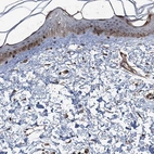 Immunohistochemical staining of human skin shows moderate nuclear positivity in subset of squamous epithelial cells.