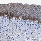Immunohistochemical staining of human urinary bladder shows moderate cytoplasmic-membranous positivity in urothelial cells.