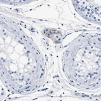 Immunohistochemical staining of human testis shows weak cytoplasmic positivity in subset of Leydig cells.