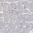 Immunohistochemical staining of human skeletal muscle shows no positivity in myocytes.