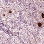 Immunohistochemical staining of human pituitary gland shows strong extracellular space positivity.