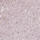 Immunohistochemical staining of human cerebral cortex shows moderate cytoplasmic positivity in neuronal processes and glial cells.