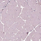 Immunohistochemical staining of human skeletal muscle shows no positivity in myocytes.