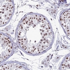 Immunohistochemical staining of human testis shows strong nuclear positivity in cells in seminiferous ducts.