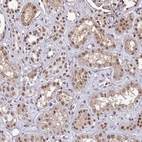 Immunohistochemical staining of human kidney shows moderate nuclear positivity in cells in tubules.