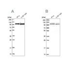 Western blot analysis using Anti-RBM12 antibody HPA043621 (A) shows similar pattern to independent antibody HPA043258 (B).