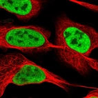 Immunofluorescent staining of human cell line U-2 OS shows localization to nucleoplasm.