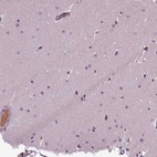 Immunohistochemical staining of human cerebellum shows moderate cytoplasmic positivity in endothelial cells and blood vessels.