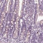 Immunohistochemical staining of human duodenum shows weak cytoplasmic positivity in glandular cells and goblet cells.