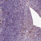 Immunohistochemical staining of human lymphoid tissues shows moderate cytoplasmic positivity in subset of non-germinal center cells.