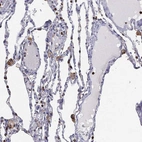 Immunohistochemical staining of human lung shows strong membranous positivity in macrophages.