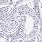 Immunohistochemical staining of human testis shows no membranous positivity in cells in seminiferous ducts as expected.