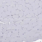 Immunohistochemical staining of human skeletal muscle shows no membranous positivity in myocytes as expected.