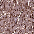 Immunohistochemical staining of human heart muscle shows strong membranous positivity in cardiomyocytes.