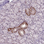 Immunohistochemical staining of human salivary gland shows strong membranous positivity in glandular cells.