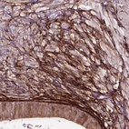 Immunohistochemical staining of human epididymis shows strong membranous positivity in smooth muscle cells cytoplasmic positivity in glandular cells.