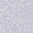 Immunohistochemical staining of human liver shows no cytoplasmic positivity in hepatocytes as expected.