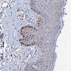 Immunohistochemical staining of human skin shows moderate membranous positivity in melanocytes.