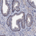 Immunohistochemical staining of human prostate shows moderate membranous positivity in glandular cells.