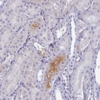Immunohistochemical staining of human kidney shows moderate cytoplasmic positivity in subset of cells in tubules.