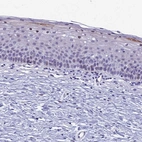 Immunohistochemical staining of human cervix, uterine shows weak cytoplasmic positivity in subset of squamous epithelial cells.