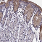 Immunohistochemical staining of human stomach shows moderate cytoplasmic positivity in subset of glandular cells.