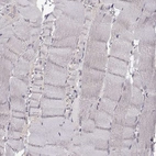 Immunohistochemical staining of human skeletal muscle shows no positivity in myocytes.