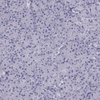 Immunohistochemical staining of human pancreas shows no positivity in exocrine glandular cells as expected.