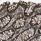 Immunohistochemical staining of human gastrointestinal shows strong membranous-cytoplasmic positivity in glandular cells.