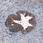 Immunohistochemical staining of human prostate shows strong membranous-cytoplasmic positivity in glandular cells.