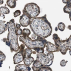 Immunohistochemical staining of human placenta shows strong membranous-cytoplasmic positivity in trophoblastic cells.
