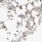 Immunohistochemical staining of human bone marrow shows nuclear positivity in hematopoietic cells.