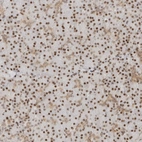 Immunohistochemical staining of human pancreas shows strong nuclear positivity in exocrine glandular cells.