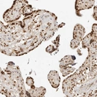 Immunohistochemical staining of human placenta shows strong nuclear positivity in trophoblastic cells.