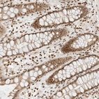 Immunohistochemical staining of human rectum shows strong nuclear positivity in lymphocytes.
