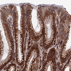 Immunohistochemical staining of human stomach shows strong cytoplasmic positivity in glandular cells and lymphoid cells.