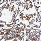 Immunohistochemical staining of human lung shows strong cytoplasmic positivity in macrophages.