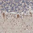 Immunohistochemical staining of human cerebellum shows moderate cytoplasmic positivity in Purkinje cells.