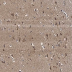Immunohistochemical staining of human cerebral cortex shows moderate cytoplasmic positivity in neuronal cells.