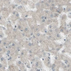 Immunohistochemical staining of human liver shows no membranous positivity in hepatocytes as expected.