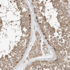Immunohistochemical staining of human testis shows moderate cytoplasmic positivity in cells in seminiferous ducts.