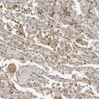 Immunohistochemical staining of human lung shows moderate cytoplasmic positivity in macrophages.