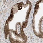 Immunohistochemical staining of human prostate shows strong cytoplasmic positivity in glandular cells.