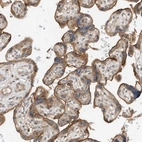 Immunohistochemical staining of human placenta shows strong cytoplasmic positivity in trophoblastic cells.