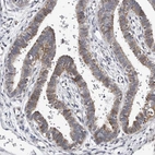 Immunohistochemical staining of human fallopian tube shows moderate positivity in cilia in glandular cells.